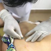 Cấy chỉ