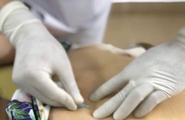 Cấy chỉ: Phương pháp hiện đại kết hợp Y học Cổ Truyền